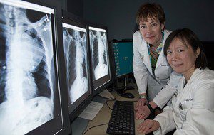 Researchers Laura Jean Bierut, MD (left), and Li-Shiun Chen, MD, examine X-rays of a patient with lung cancer. The two have found that smokers with a variation in a gene involved in processing nicotine are likely to keep smoking longer and develop cancer sooner than people who don’t have the gene variant. (Photo: Robert Boston)